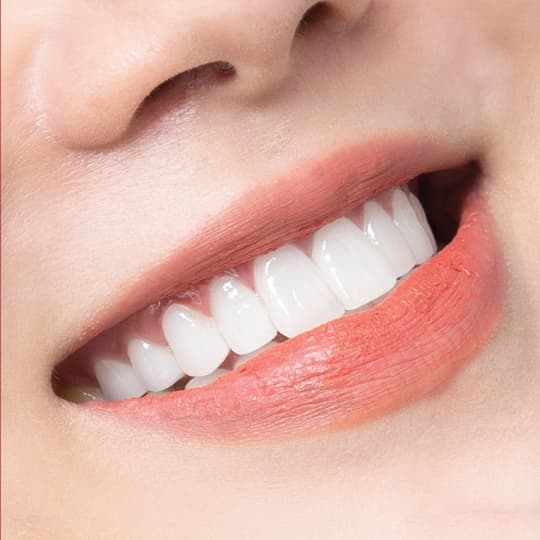 Răng sứ ORODENT