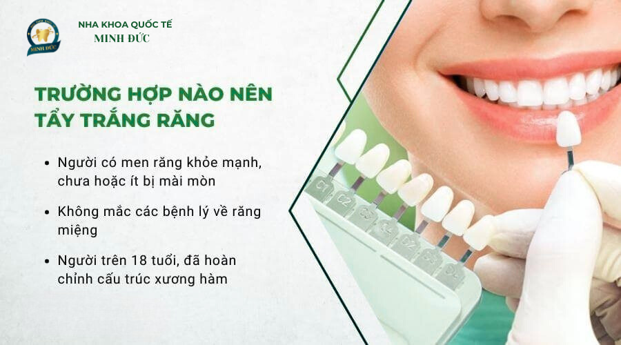 Khi nào nên tẩy trắng răng?