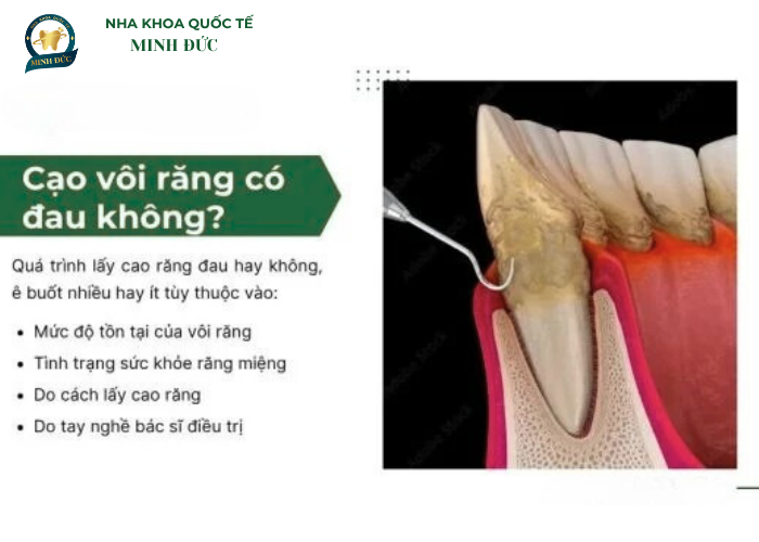 Cạo vôi răng có đau không?