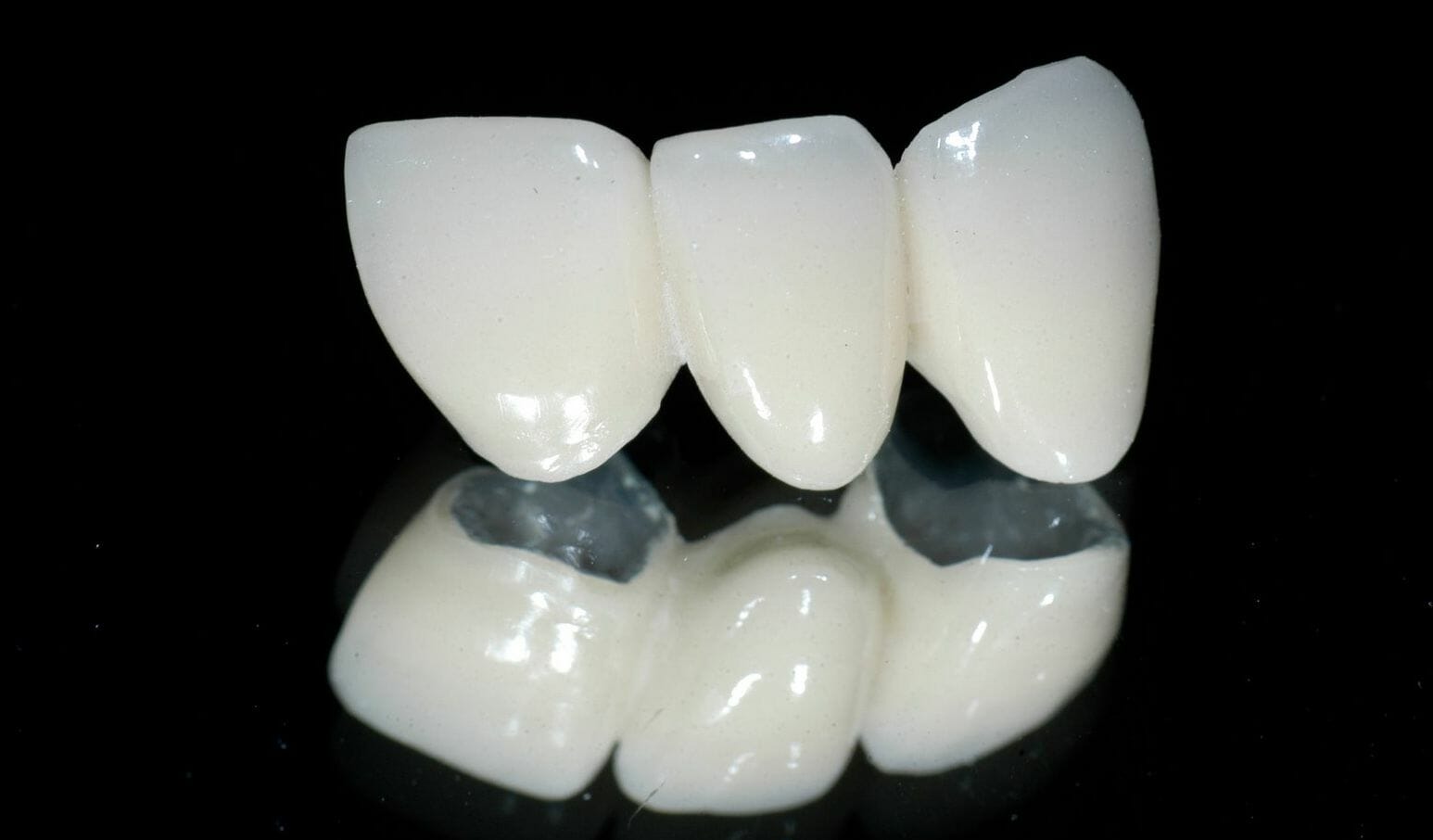 Răng sứ CERAMIL